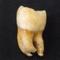 Tooth of a European-American buried in San Francisco in the 1850s. A new technique developed at UC Davis allows archaeologists to find a person?s biological sex based on a single tooth. ()
